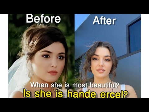 turkish actress Hande erçel plastic surgery|hayat|before and after plastic surgery|is she handeerçel