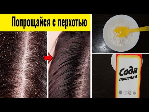 Себорея? Перхоть зуд и жирные волосы? Тогда поможет СОДА!