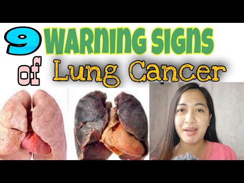 Video: Mga Tumor Sa Baga At Kanser Sa Baga Sa Mga Kuneho