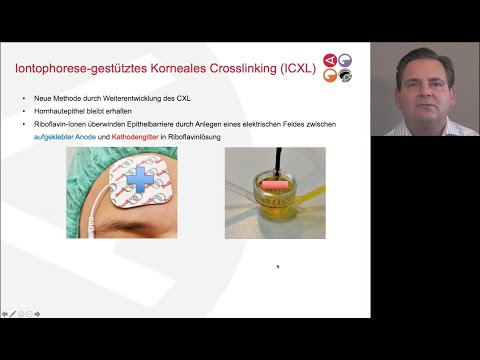 Keratokonus-Therapie: Innovativ, individualisiert und modern  – [Vortrag] 2020