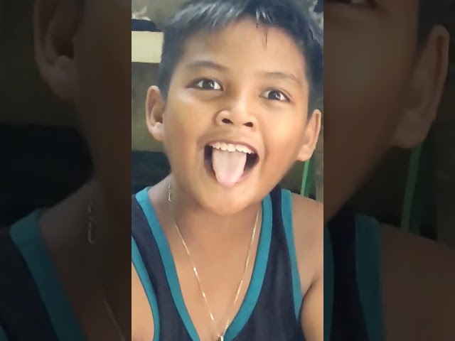 So.. So.. Kulit😅, #funny  #funnyface  #funnymoments  #funnyshorts  #funnyvideo class=