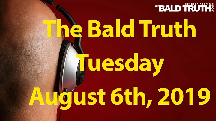 The Bald Truth for Tuesday, August 6th, 2019 - Hair loss, Hair Transplants, FUE
