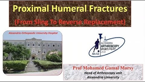 Proximal Humeral Fractures ; From Sling To Reverse Replacement Prof  Mohamed Gamal Morsy