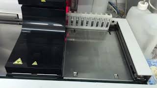 Fully automated urine chemistry machine