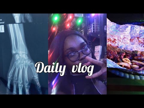 Daily vlog ✨ A day in my life, my x-ray result, night out