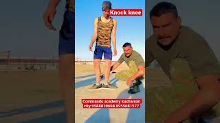 Knock knee problems || army medical test live screenshot 5