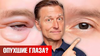 Как Убрать Мешки Под Глазами Навсегда? 🧐