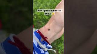 Клещи в лесу/ клещи 2023/ присосался клещ/ как бороться с клещами