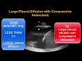 Lung ultrasound consolidation  atelectasis or pneumonia