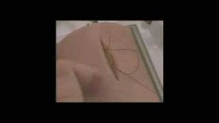 Running Subcuticular Suture - Simulab