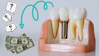 What's the Cost of Getting Dental Implants?
