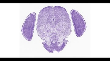 mouse brain - P4 coronal