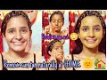 OMG 😱live result || Remove sun tan naturally at HOME 🌞 || Home Remedies | #preetisarma