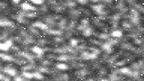 Dynamic Speckle of Tissue Sample