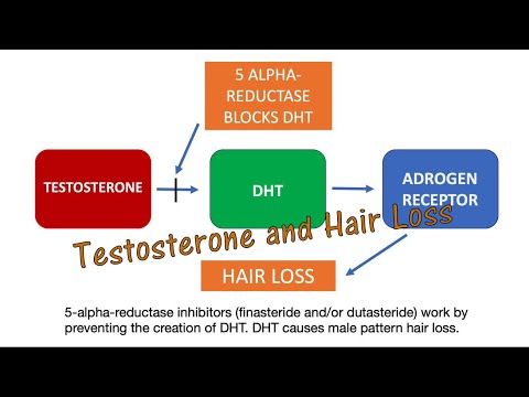 ghk-cu inhibits 5-alpha reductase dht hair loss Genetic Hair Loss - It's All About Testosterone