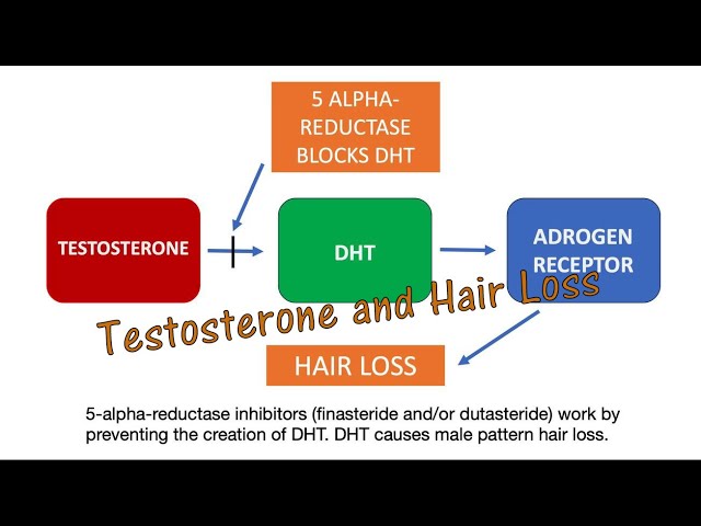 Genetic Hair Loss - It's All About Testosterone