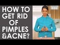 3 best home remedies to get rid of forehead pimples acne  bumps