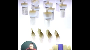 IPS e.max press Multi in a clinic case ..  some further advantages that you probably not aware of!