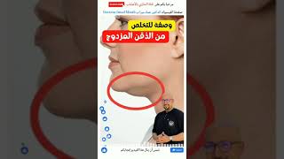 وصفة للتخلص من الذقن المزدوج الدكتور عماد ميزاب Docteur Imad Mizab #short #shortvideo #shortsvideo