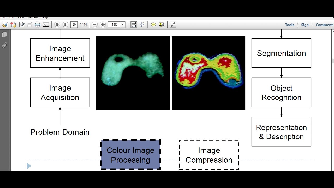 KEY STAGES IN DIGITAL IMAGE PROCESSING PROCESS PART 2| DIGITAL IMAGE ...