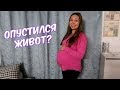 ОПУСТИЛСЯ ЖИВОТ?