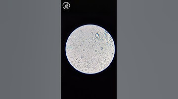 Egg Yolk and Egg White Under the Microscope #microscope #egg #science