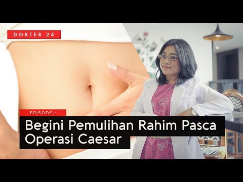 Video: Cara Sederhana Mengecilkan Perut Setelah Operasi Caesar: 11 Langkah