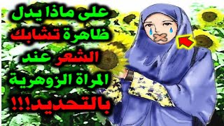 على ماذا يدل ظاهرة تشابك الشعر عند المراة الزوهرية بالتحديد