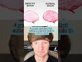 Smooth Brain Syndrome