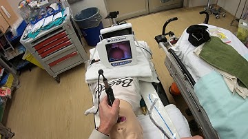 Optimized Hyperangulated VL