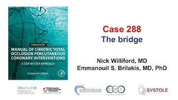 Case 288: Manual of CTO PCI - The bridge