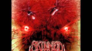 SKINNED &quot;Fiend For Flesh&quot; Spawn of Insanity 2005