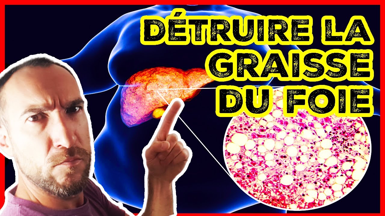 Comment ÉLIMINER La GRAISSE sur le FOIE : Foie Gras ... Comment ÉLIMINER La GRAISSE sur le FOIE : Foie Gras ...