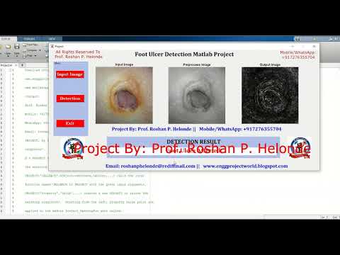 Foot Ulcer Detection Using Deep Learning CNN | Foot Ulcer Classification Using Matlab | Ulcer Detect