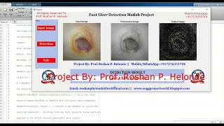 Foot Ulcer Detection Using Deep Learning CNN | Foot Ulcer Classification Using Matlab | Ulcer Detect Ulcer Detection Using Image Processing Matlab Project Code
