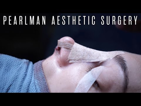 full-rhinoplasty-surgery---dr.-steven-pearlman-|-part-2