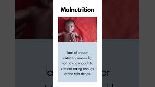 Malnutrition #english #vocabulary #learnenglish #pronunciation #englishvocabulary #malnutrition