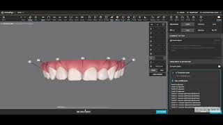 Invisalign Clincheck Construction to Minimize attachments and Maximize Tracking