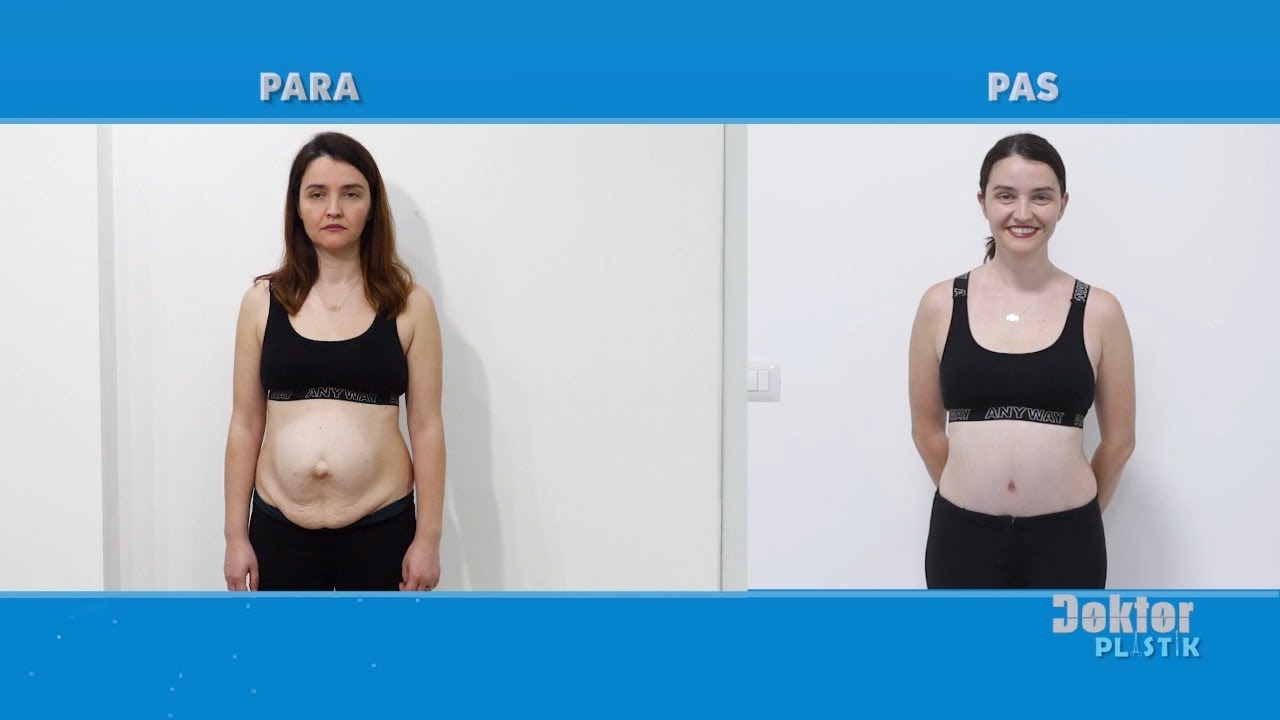 Kengetarja i drejtohet Doktor Plastik, ja cila ishte nderhyrja qe realizoi ne Spitalin Amerikan