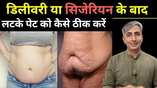 डिलीवरी या सिजेरियन के बाद बड़े पेट को कैसे कम करें I REDUCE BELLY FAT AFTER DELIVERY DR. MANOJ DAS