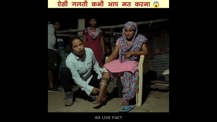 सांप काटने के बाद 🙏।    #short