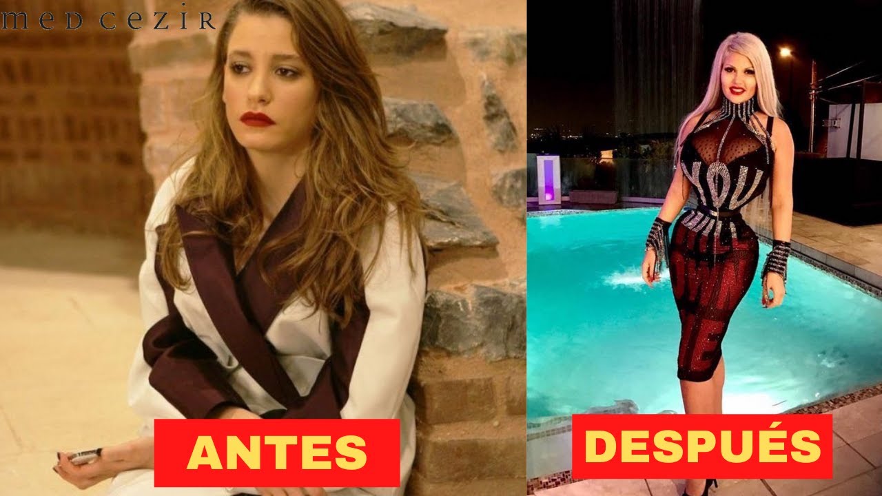 Antes y después de los actores de medcezir