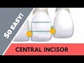 Maxillary central incisor | ANOTOMY |