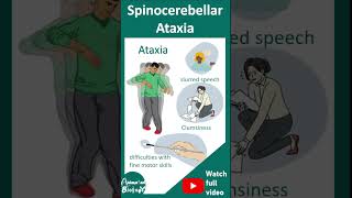 Spinocerebellar ataxia (SCA) | pathology ,diagnosis and treatment | 1 minute pathology