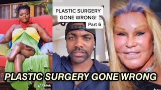 PLASTIC SURGERY GONE WRONG | PART 2