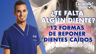 ¿Te FALTA algún DIENTE? 12 formas de REPONER los dientes caídos o perdidos | Dentalk! ©