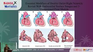How to Use All Diagnostic Modalities to Optimize the Surgical DORV Repair Outcome - Loh Yee Jim
