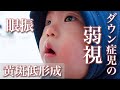 【眼振】ダウン症1歳・今わかる目の問題を全部聞いてきた【黄斑低形成】