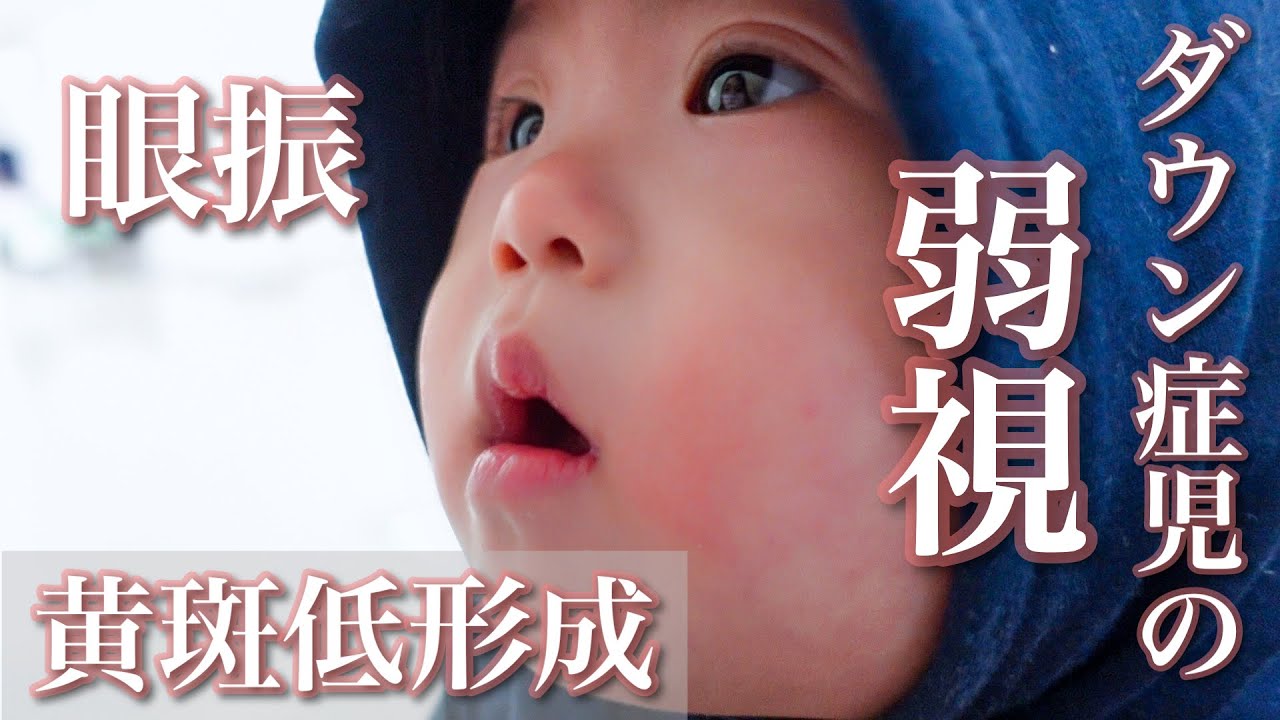 眼 振 動画