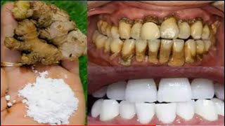 في دقيقة ، كيفية التخلص من اصفرار الأسنان . خليط طبيعي لتبييض الأسنان